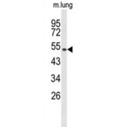 MutY Homolog (MUTYH) Antibody