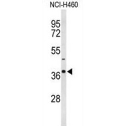 Peroxisomal Membrane Protein PMP34 (SLC25A17) Antibody