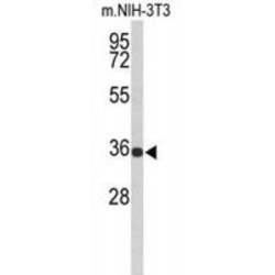 Peroxisomal Membrane Protein PMP34 (SLC25A17) Antibody