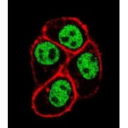 Parafibromin (CDC73) Antibody