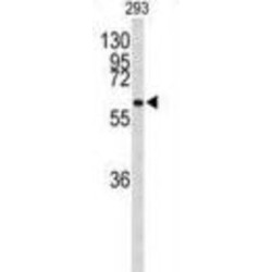 Parafibromin (CDC73) Antibody