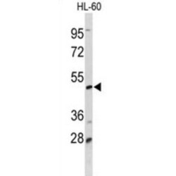 m7GpppN-mRNA Hydrolase (DCP2) Antibody