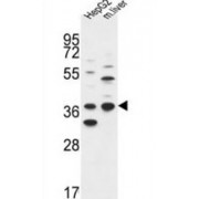 Short-Chain Dehydrogenase/Reductase 3 (DHRS3) Antibody