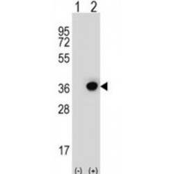 Short-Chain Dehydrogenase/Reductase 3 (DHRS3) Antibody