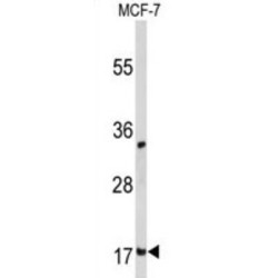 Destrin (DSTN) Antibody