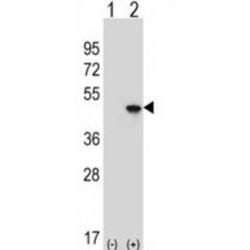 Eukaryotic Initiation Factor 4A-II (EIF4A2) Antibody