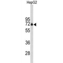 F-Box Protein 3 (FBXO3) Antibody