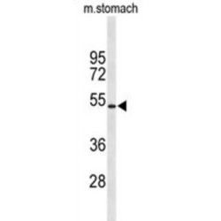 Potassium Voltage-Gated Channel Subfamily J Member 11 (KCNJ11) Antibody