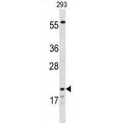 Claudin 8 (CLDN8) Antibody