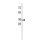 Uroplakin-1a (UPK1A) Antibody