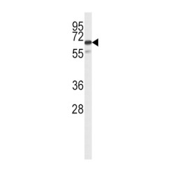 Solute Carrier Family 22 Member 6 (SLC22A6) Antibody