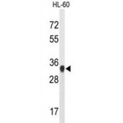 ATP Synthase Subunit Gamma, Mitochondrial (ATP5F1C) Antibody