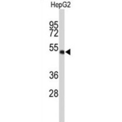 WD Repeat-Containing Protein 37 (WDR37) Antibody