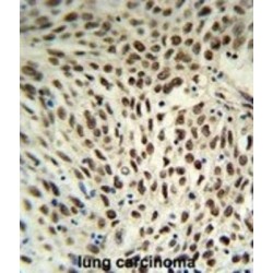 Small Nuclear Ribonucleoprotein D3 Polypeptide (SNRPD3) Antibody