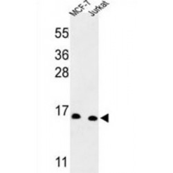 Small Nuclear Ribonucleoprotein D3 Polypeptide (SNRPD3) Antibody