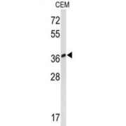 WB analysis of CEM cell line lysates (35 µg).