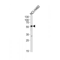 Gamma-Aminobutyric Acid Receptor Subunit Alpha-2 (gABRA2) Antibody