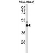 Western blot analysis of MDA-MB435 cell line lysates, using gABRD Antibody.