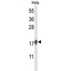 P21Cip1 Antibody