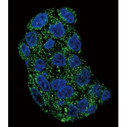 Glutathione Peroxidase 1 (GPX1) Antibody