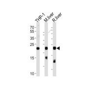 WB analysis of THP-1 cell lysates, mouse liver and rat liver lysates, using GPX1 antibody (1/1000 dilution).