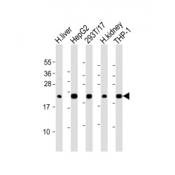 Glutathione Peroxidase 1 (GPX1) Antibody