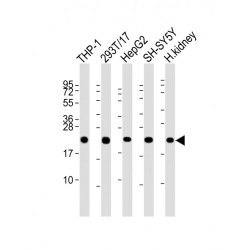 Glutathione Peroxidase 1 (GPX1) Antibody