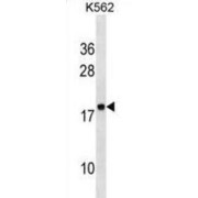 60S Acidic Ribosomal Protein P2 (RPLP2) Antibody