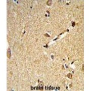 IHC-P analysis of human brain tissue, with DAB staining.