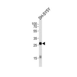 Neuronal Membrane Glycoprotein M6-A (GPM6A) Antibody