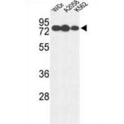 Beta-Glucuronidase (GUSB) Antibody