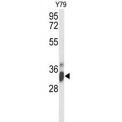 U3 Small Nucleolar Ribonucleoprotein Protein IMP4 (IMP4) Antibody