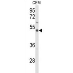 Zinc Transporter ZIP8 (S39A8) Antibody