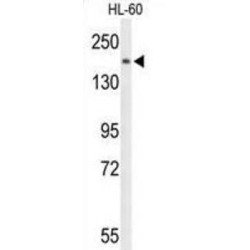 Phospholipase C Beta 1 (PLCB1) Antibody