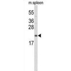 Interleukin 31 (IL31) Antibody