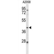 3-Galactosyl-N-Acetylglucosaminide 4-Alpha-L-Fucosyltransferase FUT3 (FUT3) Antibody