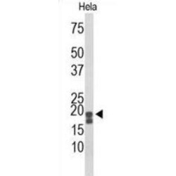 Acid Phosphatase 1 (ACP1) Antibody