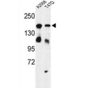 WB analysis of (1) A2058, and (2) T47D cell line lysates.