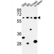 Phospholipase C Zeta 1 (PLCZ1) Antibody