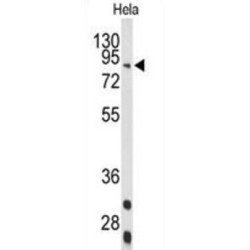 Stimulated By Retinoic Acid 6 (STRA6) Antibody