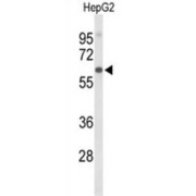 Afamin (AFM) Antibody