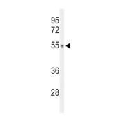 DiGeorge Syndrome Critical Region Gene 2 (DGCR2) Antibody