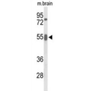 Growth Factor Receptor Bound Protein 7 (GRB7) Antibody