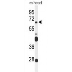 Frizzled Homolog 4 (FZD4) Antibody