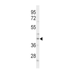 CCAAT/Enhancer Binding Protein Alpha (CEBPA) Antibody