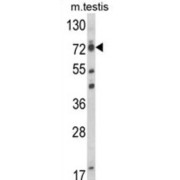 Elongation Factor RNA Polymerase II (ELL) Antibody