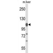 Glycine Dehydrogenase (GLDC) Antibody