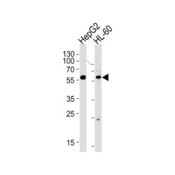 Fanconi Anemia Complementation Group C (FANCC) Antibody