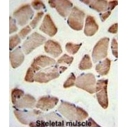 Beta-1,3-N-Acetylglucosaminyltransferase Lunatic Fringe (LFNG) Antibody