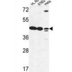 Beta-1,3-N-Acetylglucosaminyltransferase Lunatic Fringe (LFNG) Antibody